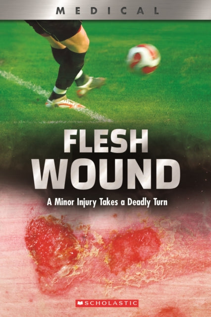 Flesh Wound (XBooks) : A Minor Injury Takes a Deadly Turn-9780531132968